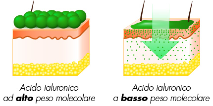 medea medicina estetica acido ialuronico