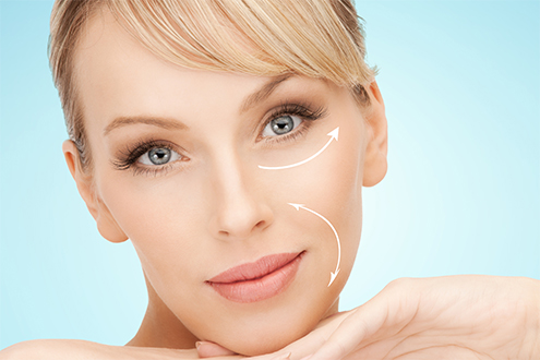 medea medicina estetica Soft Lifting Con Fili Riassorbibili Silhouette