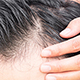 Capelli